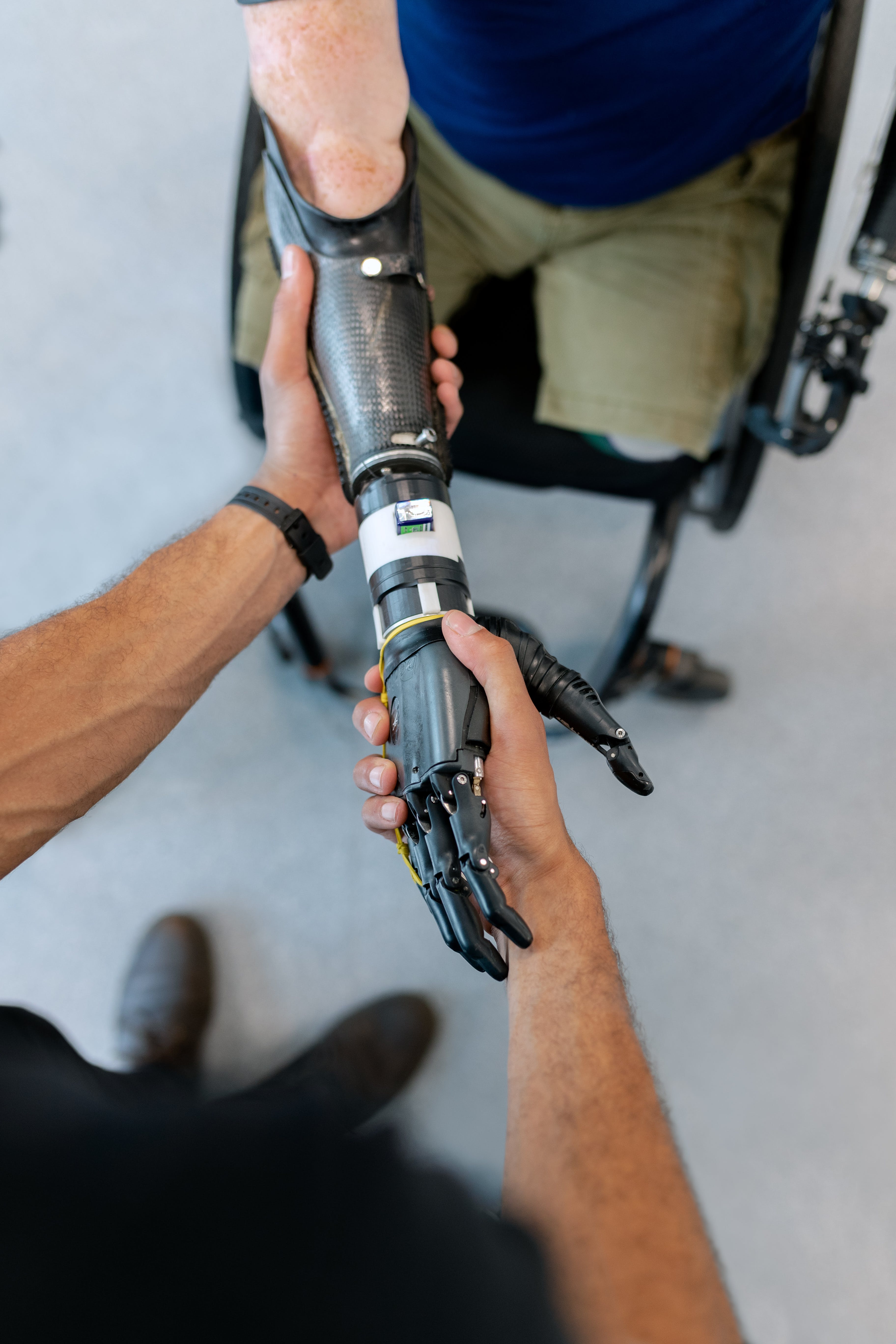 Prosthetic limb